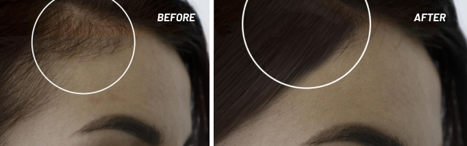 Akemi Revive use